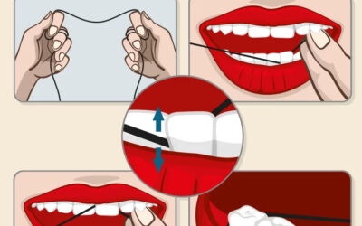 How to Floss your Teeth?