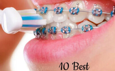 Which toothbrush to use with braces?