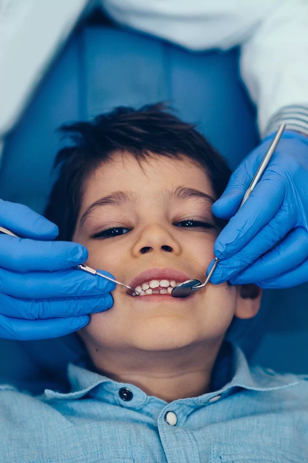 what-causes-cavities-and-why-do-my-children-continue-to-get-them