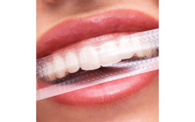 How Often Should You Use Whitening Strips?